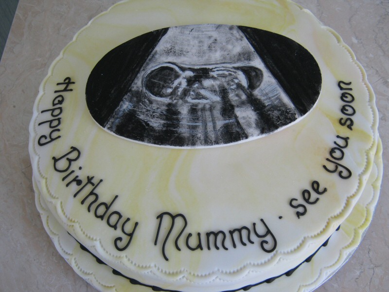 Helen - 30th birthday cake showing her baby's scan